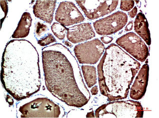 TTR Antibody