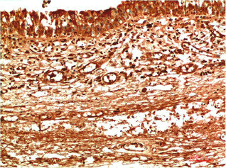 TTR Antibody