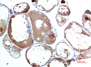 TTR Antibody