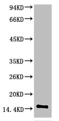 TTR Antibody
