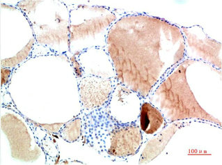 TTR Antibody