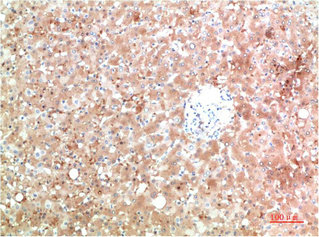 TTR Antibody