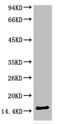 TTR Antibody
