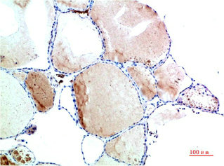 TTR Antibody