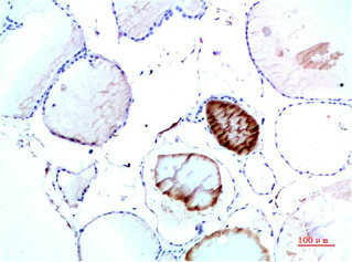 TTR Antibody