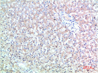 TTR Antibody