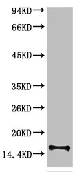 TTR Antibody