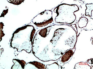 TTR Antibody