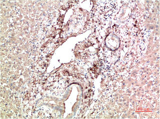 TTR Antibody