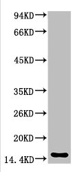 TTR Antibody