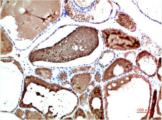 TTR Antibody