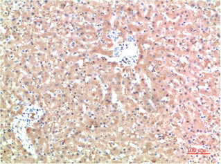 TTR Antibody