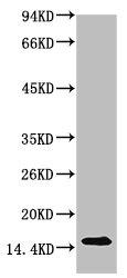 TTR Antibody