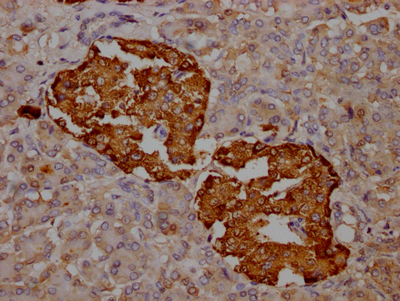 TTR Antibody