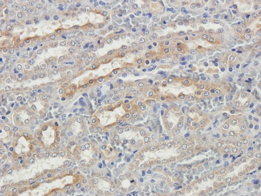 TRAPPC11 Rabbit Polyclonal Antibody