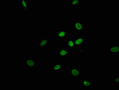 TRAPPC11 Antibody