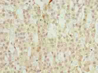 TRAPPC6B Antibody
