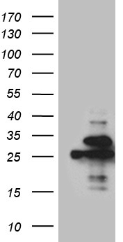 TARBP2 Antibody