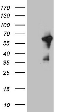 TARBP2 Antibody
