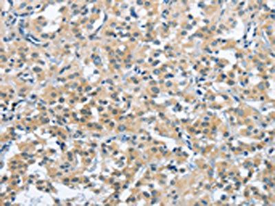 TRDMT1 Antibody