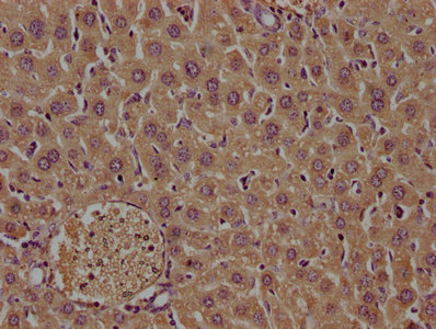 Tf Antibody