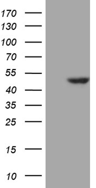 TRIB3 Antibody