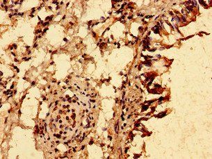TRIM21 Antibody