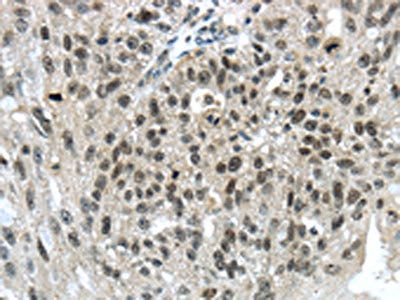 TRIM24 Antibody