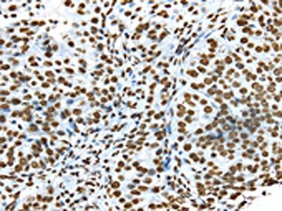 TRIM27 Antibody