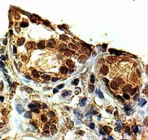 KAP1/TRIM28 Antibody
