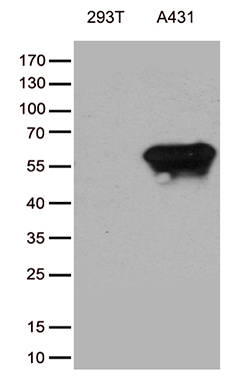 TRIM29 Antibody