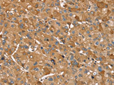TRIM34 Antibody