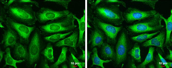 triosephosphate isomerase 1 Antibody