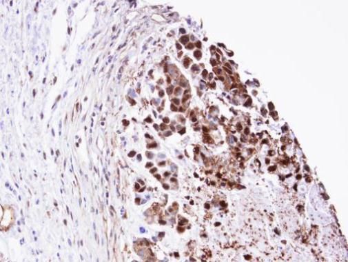 triosephosphate isomerase 1 Antibody