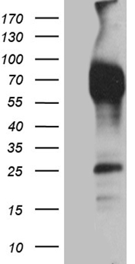 TRIP13 Antibody