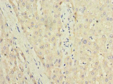 TRIT1 Antibody