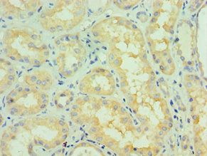 NTRK2 Antibody