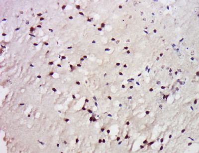 TrkC Rabbit Polyclonal Antibody
