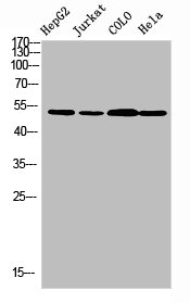 TRMT11 Antibody