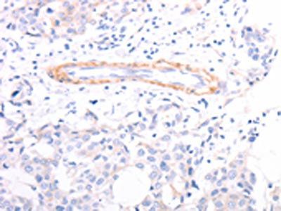 TPM1 Antibody