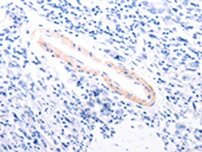 TPM1 Antibody