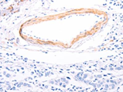 TPM1 Antibody
