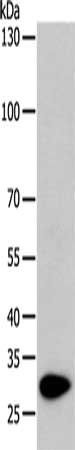 TPM1 Antibody