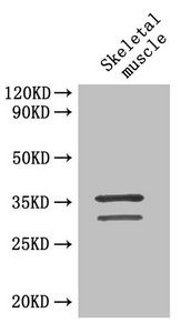 TNNT2 Antibody