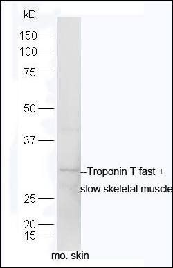 Troponin T fast + slow skeletal muscle Rabbit Polyclonal Antibody