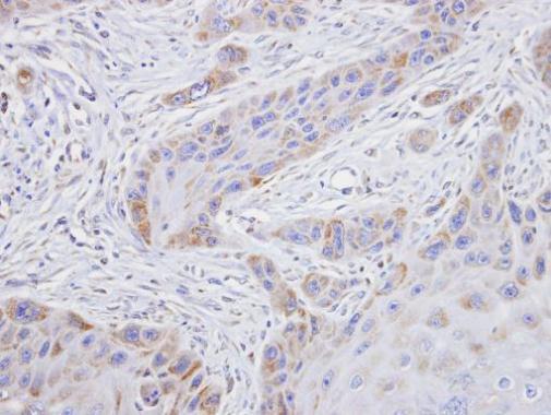 TROVE2 Rabbit Polyclonal Antibody