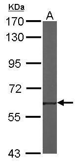 TROVE2 Rabbit Polyclonal Antibody