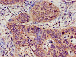 TRPC1 Antibody