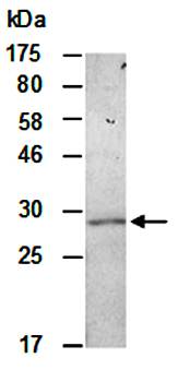 PRSS1 (N) Antibody, Rabbit Polyclonal