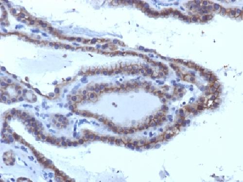 TSHR Antibody